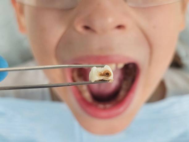 Best Emergency Pediatric Dental Care in Gower, MO
