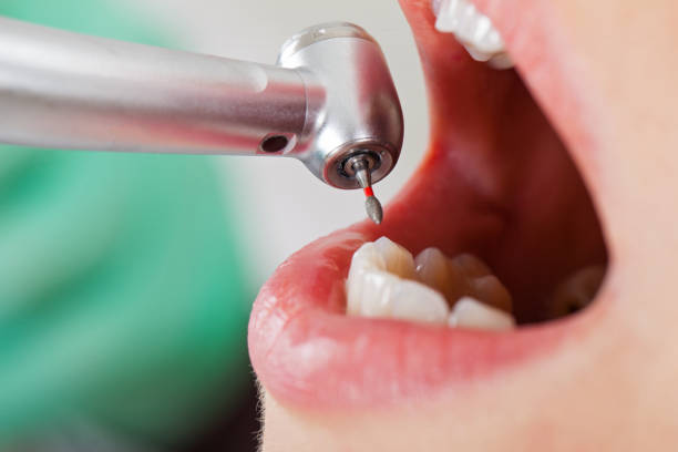 Best Broken or Chipped Tooth Repair in Gower, MO